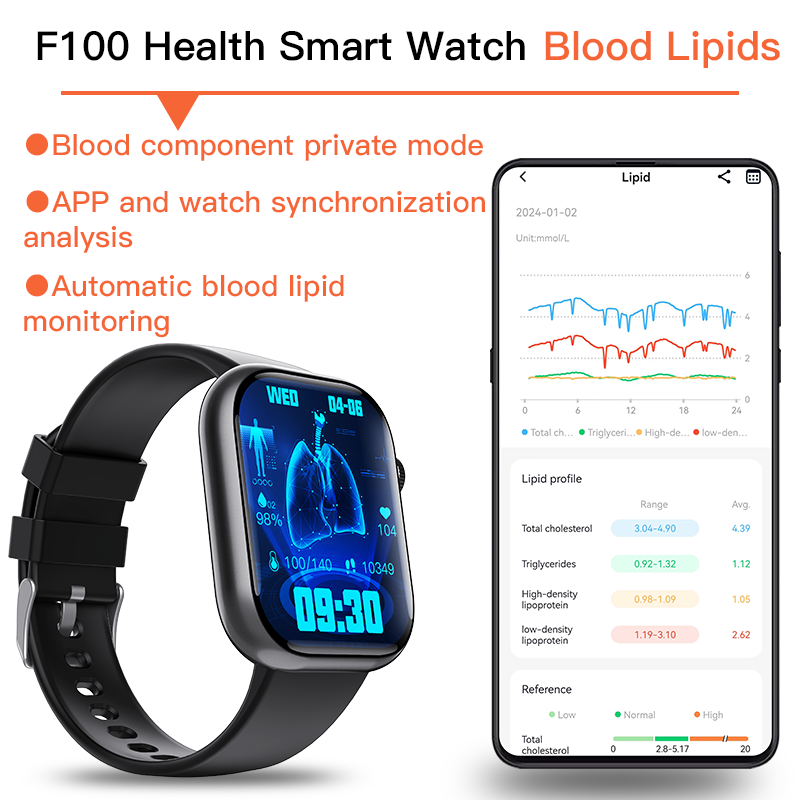 ECG Smart Watch of 2025 With Blood Pressure Monitor+Blood Glucose Monitoring